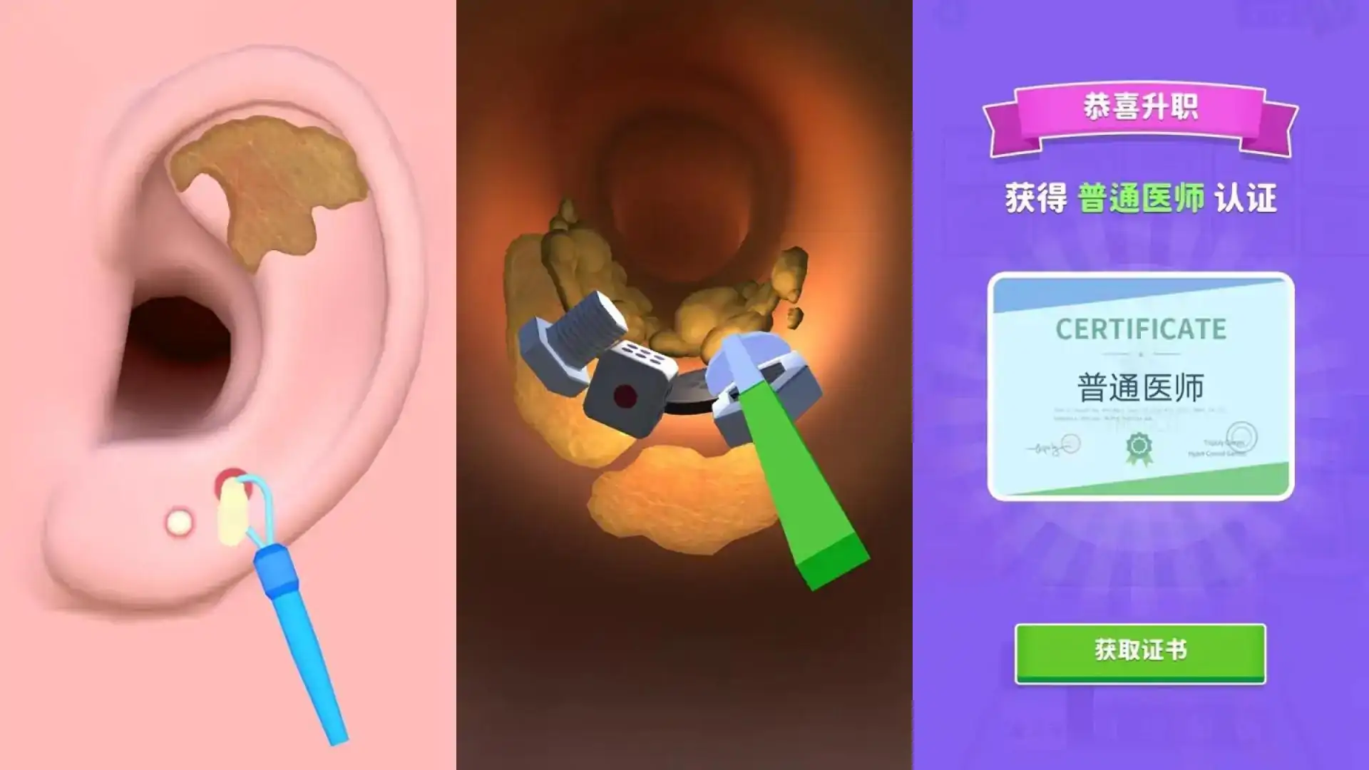 你是来掏耳屎的吧